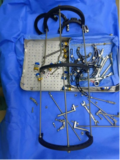 【最新病例】三臂十一軸機器人輔助器牽引——骨折外固定術(shù)骨折案例分享